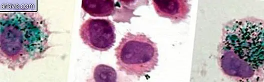 makrofágy