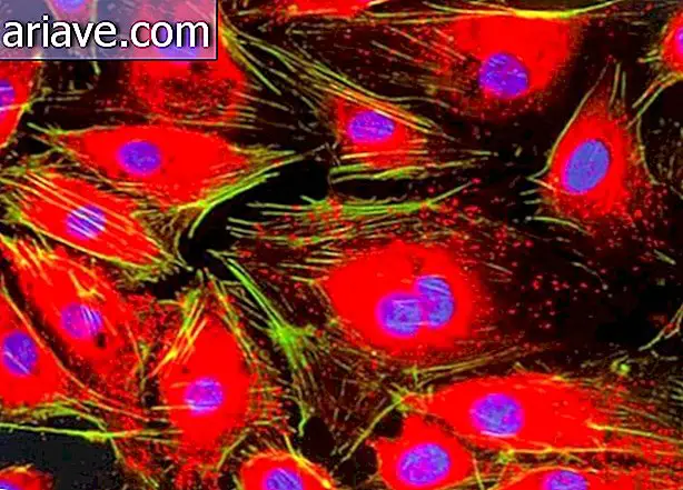 1998 - A fenti kép endotélsejteket mutat (egy olyan típusú sejt, amely az erek belsejét béleli). Jakob Zbaeren kattintott rá a svájci Bernben található Inselspital Egyetemi Kórházból.