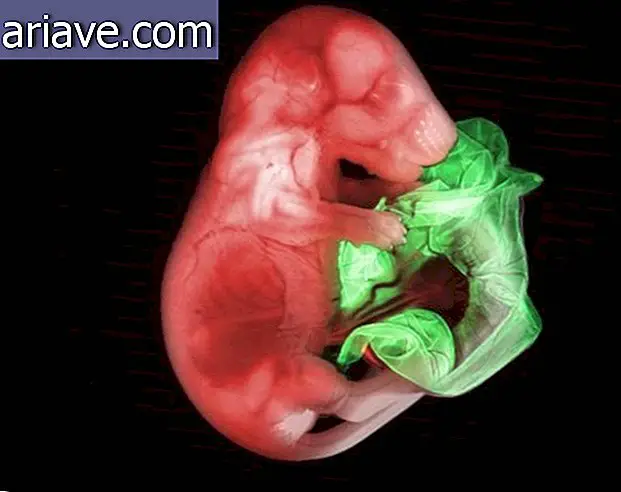 2007 - Das obige Foto von Gloria Kwon vom US Memorial Sloan Kettering Cancer Center zeigt das Herz eines 18, 5 Tage alten Doppelmäuseembryos.