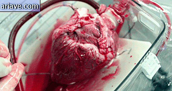 Človeško srce