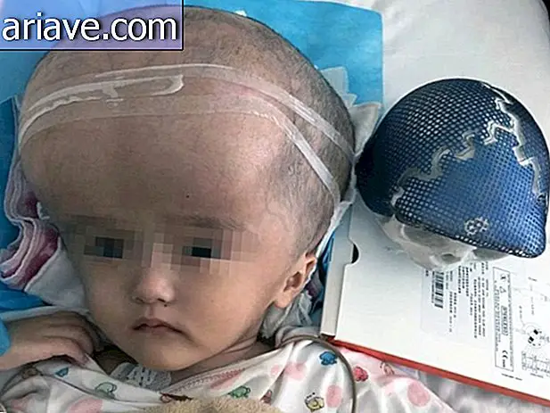 Drukarka 3D ratuje życie chińskiego dziecka