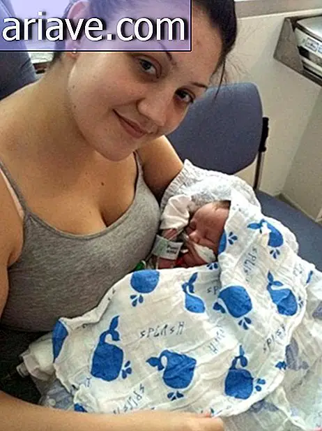 Tıp Mucizesi: Bebek Gut Çıkarak Doğmaktan Bile Kurtulur