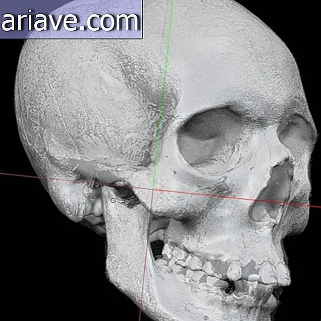 Cranio umano