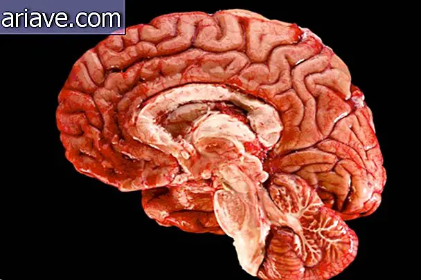 สมองของมนุษย์