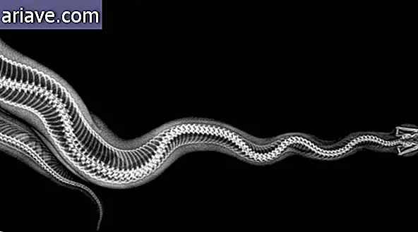Egy kígyó röntgenképe