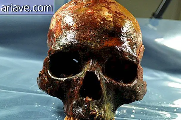 Cranio umano