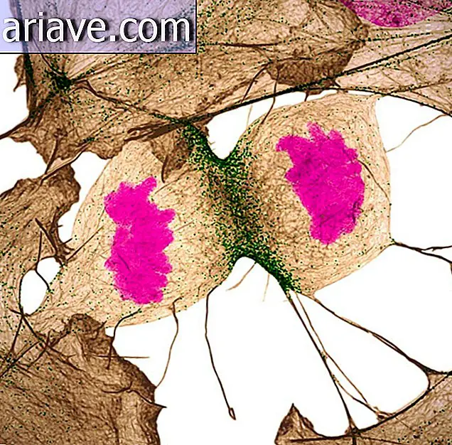 Menneskelig fibroblast