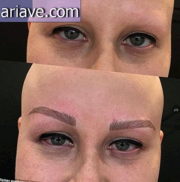 Nach dem Verlust aller Körperbehaarung feiert die junge Frau neue Augenbrauen