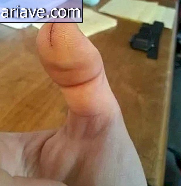 Corte del dedo gordo