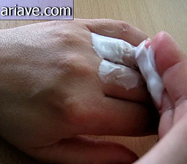 Opi 7 älykästä tapaa sormenrenkaan poistamiseksi