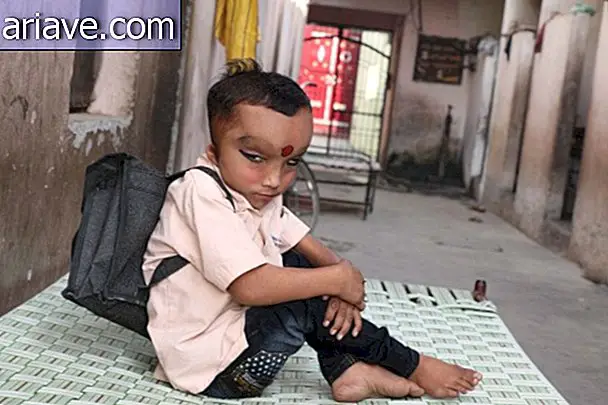Poikaa, jolla on tuntematon sairaus, palvotaan hindu jumalana Intiassa