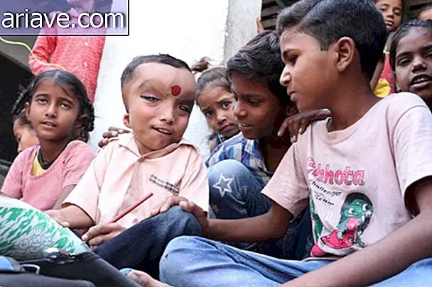 Poikaa, jolla on tuntematon sairaus, palvotaan hindu jumalana Intiassa