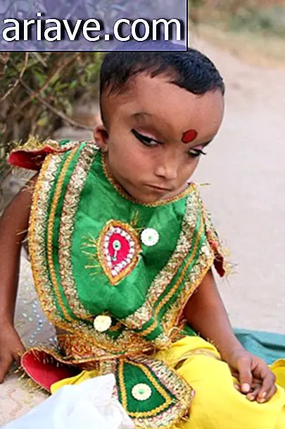 Cậu bé với tình trạng y tế không rõ được tôn thờ là Thần Hindu ở Ấn Độ