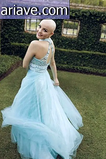 Tânărul cu cancer face ședințe foto uimitoare după ce și-a pierdut părul
