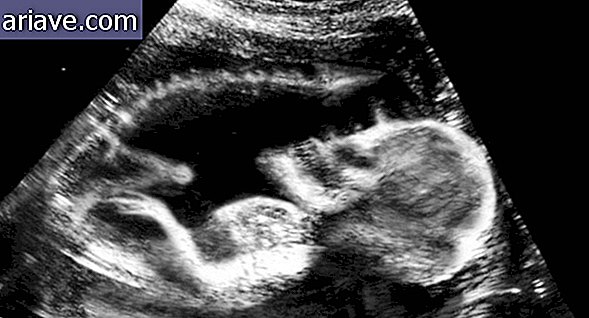 Vystrašujúce: Tieto ultrazvuk vás prinúti dvakrát rozmýšľať o tom, že máte deti
