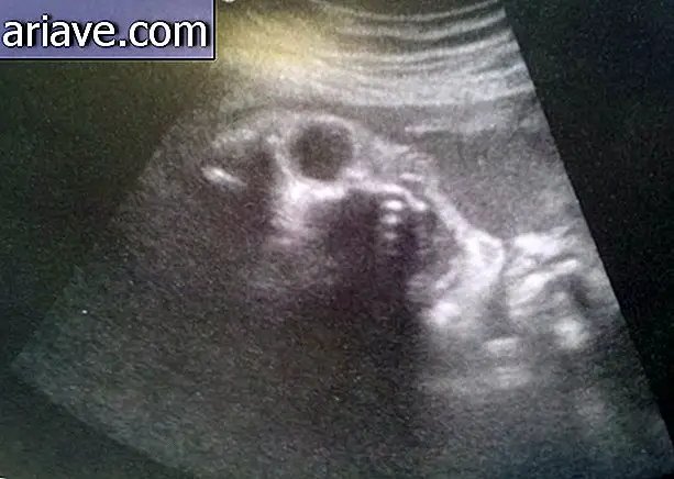 Spaventoso: questi ultrasuoni ti faranno riflettere due volte sull'avere figli