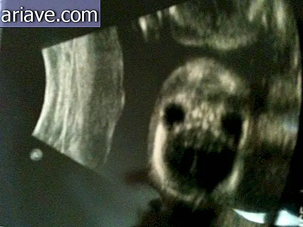 Vystrašujúce: Tieto ultrazvuk vás prinúti dvakrát rozmýšľať o tom, že máte deti