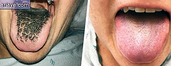 lengua peluda