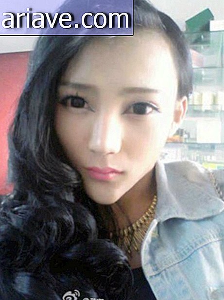 Cô gái Trung Quốc trải qua phẫu thuật và chiến thắng khuôn mặt hoạt hình