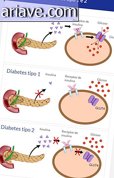 Tipos de diabetes