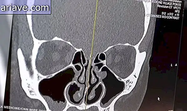 Radiografia del cranio